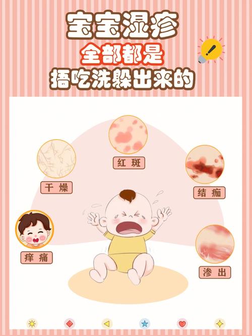 国内第三代助孕宝宝湿疹可以吃什么